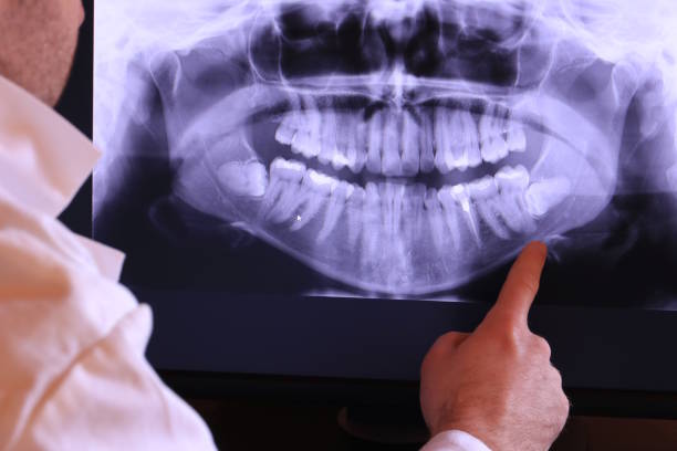 Best Emergency Treatment for Toothache in Falls Church, VA
